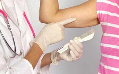 2 Implantes anticonceptivos