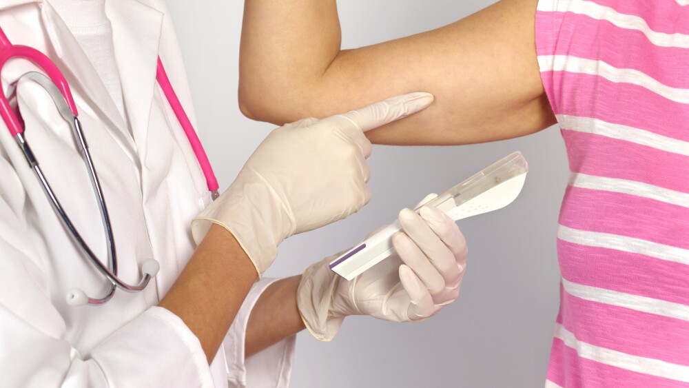 2 Implantes anticonceptivos