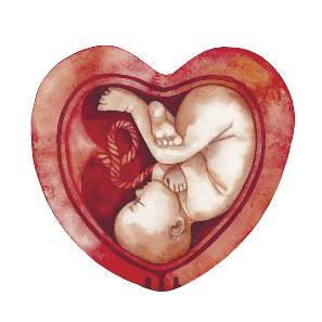 Qué es la placenta acreta o placenta adherida