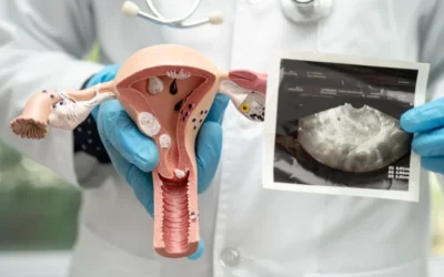 Endometritis