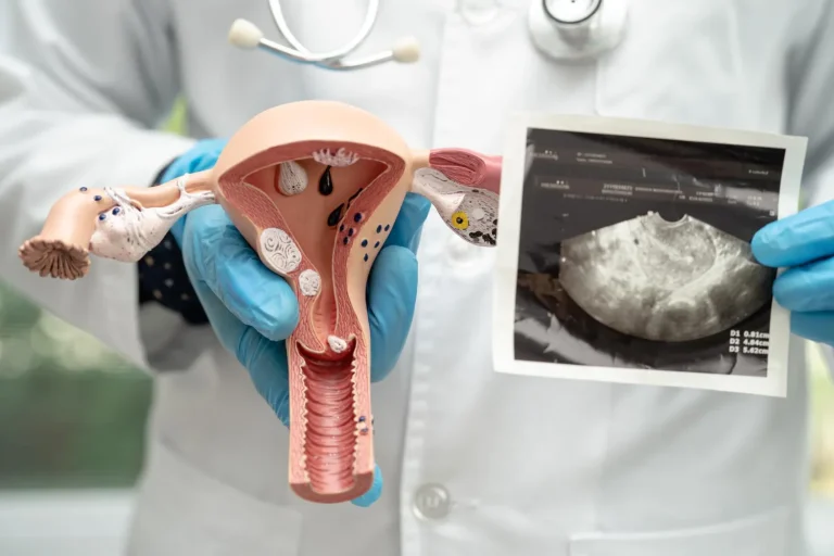 Endometritis