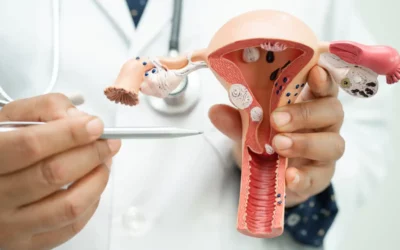 Síndrome Ovario Poliquístico (SOP)