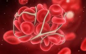 Síndrome Antifosfolípido (SAF)